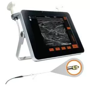 Foto de Ultrassom Guiado Microendoscopia